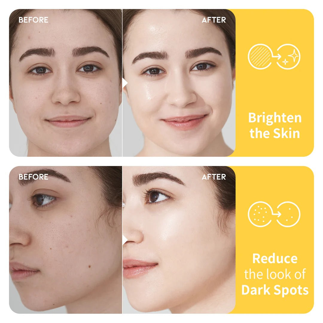 DARK SPOT VITAMIN C TONER