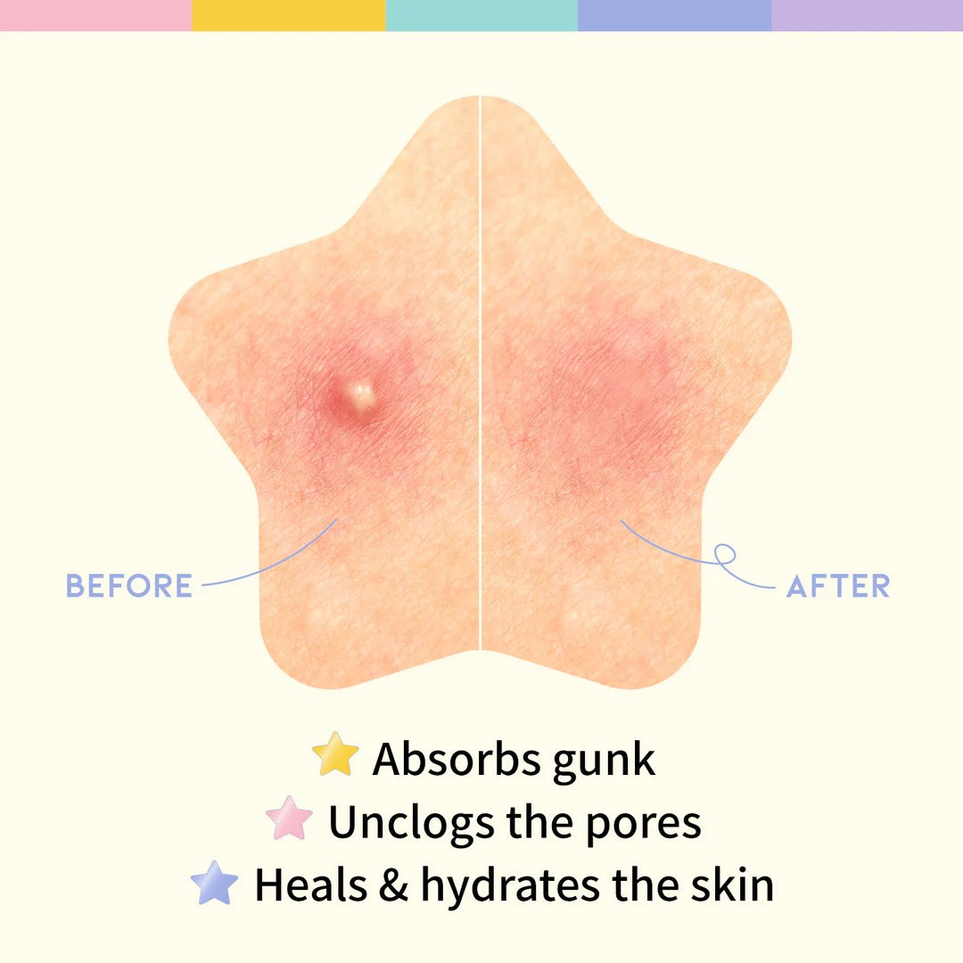STAR SPOT PATCH (80 DOTS)