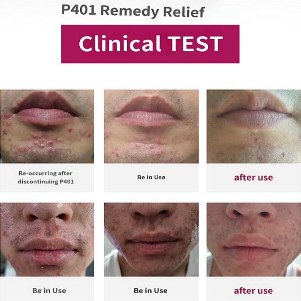 P401 REMADY SOLUTION AMPULE 5ml*5ea