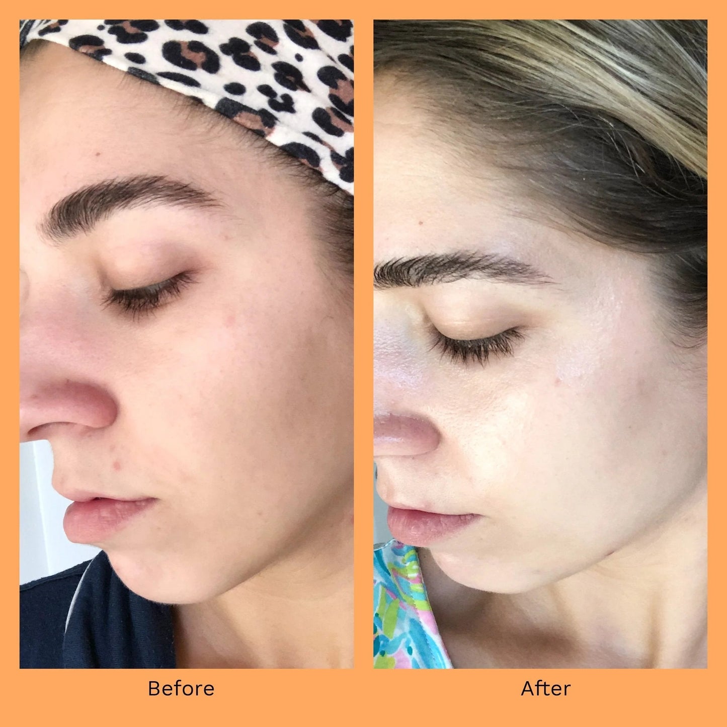 Carrot + Niacinamide Moisturing Cream 50ml