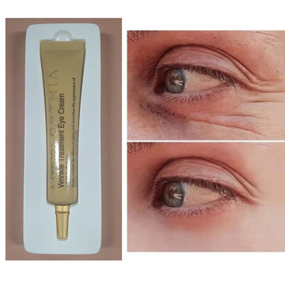 coreana ORTHIA WRINKLE TREATMENT EYE CREAM